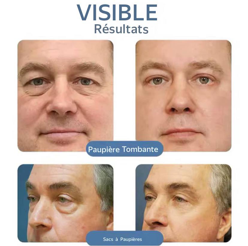 Crème Anti-Cernes & Anti-Poches